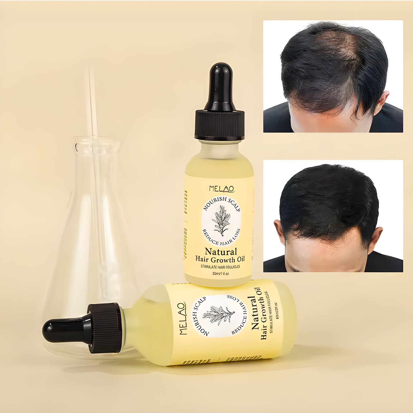 Natural Hair Growth Oil