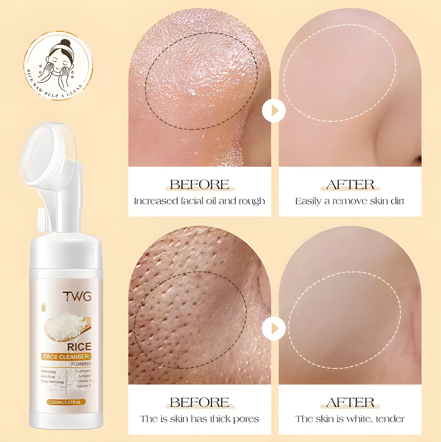 Rice Foaming Face Wash Anti Acne
