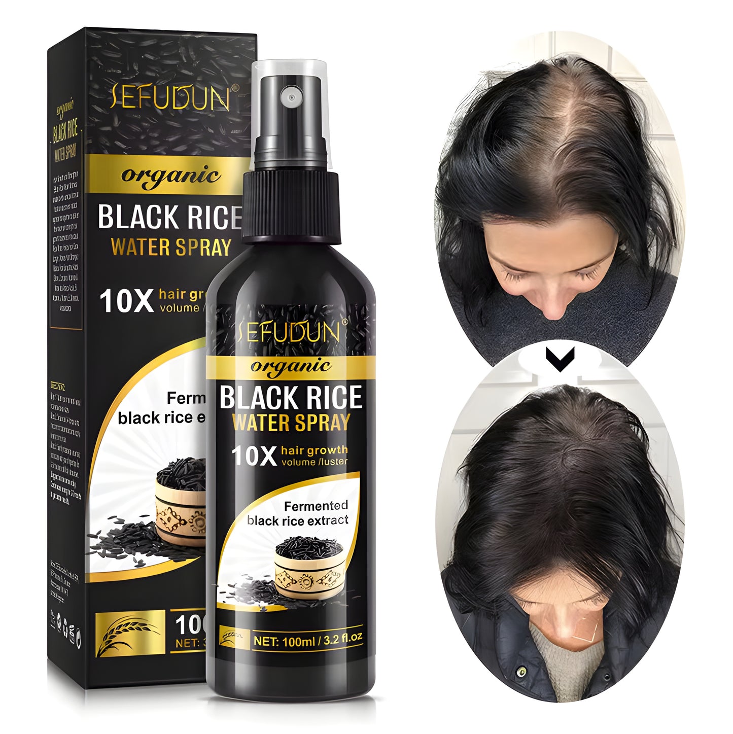 Hair Loss Treatment Biotin Black Rice Water Spray